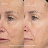 SeneCellâ„¢ SenePlex+Â® StemCell Concentrate