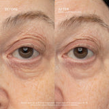 SeneCellâ„¢ SenePlex+Â® StemCell Concentrate