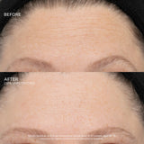SeneCellâ„¢ SenePlex+Â® StemCell Concentrate